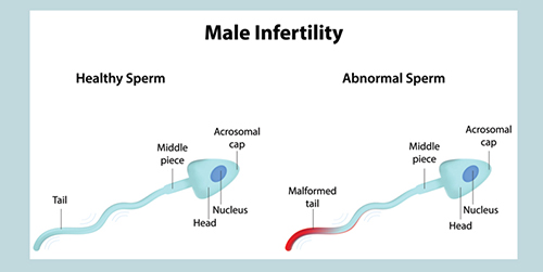 IVF Specialist in Delhi